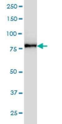 Western Blot: Desmocollin-3 Antibody (4D2) [H00001825-M01]