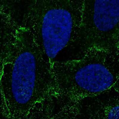 Immunocytochemistry/ Immunofluorescence: Desmocollin-3 Antibody [NBP2-56621]