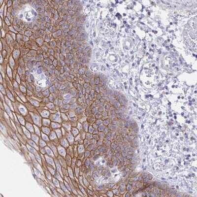 Immunohistochemistry-Paraffin: Desmocollin-3 Antibody [NBP2-31886]