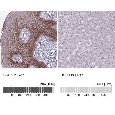 Immunohistochemistry-Paraffin: Desmocollin-3 Antibody [NBP2-31886]