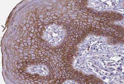 Immunohistochemistry-Paraffin: Desmocollin-3 Antibody [NBP2-31886]