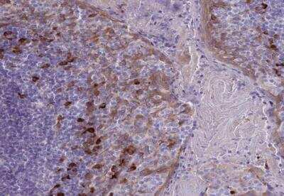 Immunohistochemistry-Paraffin: Desmocollin-3 Antibody [NBP2-31886]