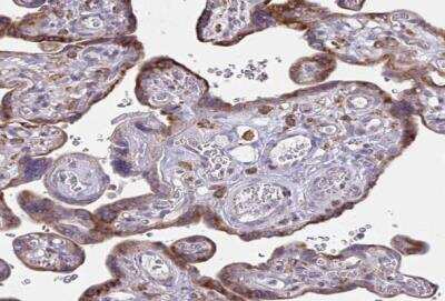 Immunohistochemistry-Paraffin: Desmocollin-3 Antibody [NBP2-31886]