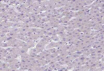 Immunohistochemistry-Paraffin: Desmocollin-3 Antibody [NBP2-31886]