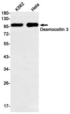 Western Blot: Desmocollin-3 Antibody (S06-4G2) [NBP3-19518]