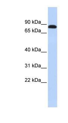 Western Blot: Desmocollin-3 Antibody [NBP1-59227]