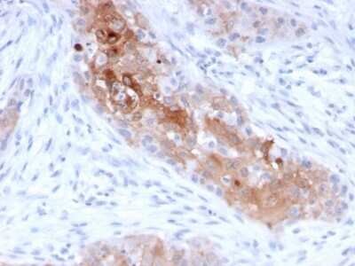 Immunohistochemistry-Paraffin: Desmoglein-1 Antibody (32-2B) - Azide and BSA Free [NBP3-08662]