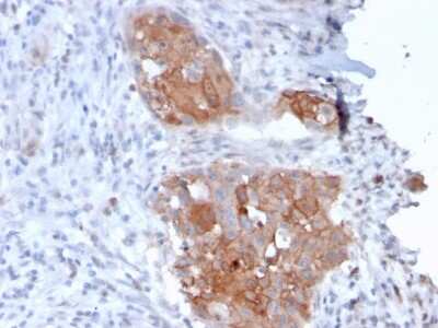 Immunohistochemistry-Paraffin: Desmoglein-1 Antibody (32-2B) - Azide and BSA Free [NBP3-08662]