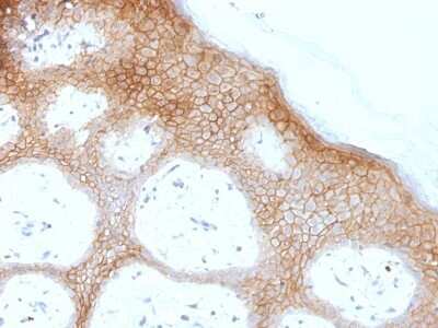 Immunohistochemistry-Paraffin: Desmoglein-1 Antibody (DSG1/1733) - Azide and BSA Free [NBP2-54377]