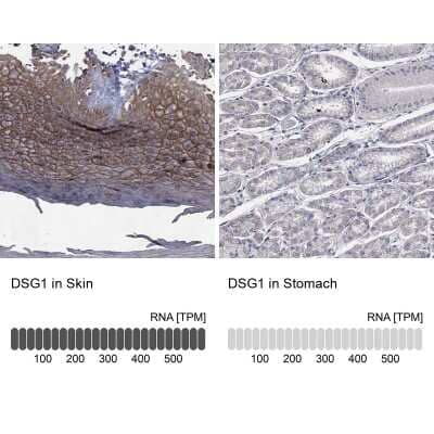 Immunocytochemistry/ Immunofluorescence: Desmoglein-1 Antibody [NBP3-17012]