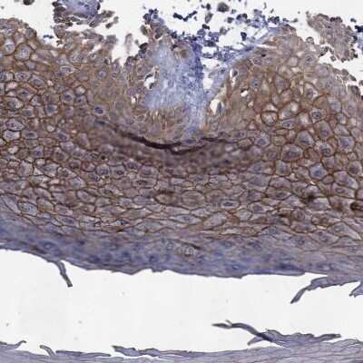 Immunohistochemistry-Paraffin: Desmoglein-1 Antibody [NBP3-17012]