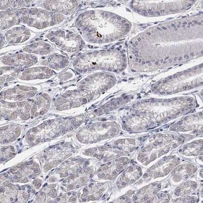Immunohistochemistry-Paraffin: Desmoglein-1 Antibody [NBP3-17012]