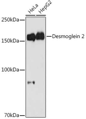 Western Blot: Desmoglein-2 Antibody (8O0R6) [NBP3-16421]