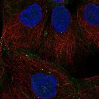Immunocytochemistry/ Immunofluorescence: Desmoglein-2 Antibody [NBP1-85709]
