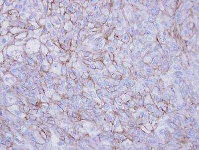 Immunohistochemistry-Paraffin: Desmoglein-2 Antibody [NBP1-33374]