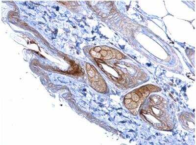 Immunohistochemistry-Paraffin: Desmoglein-2 Antibody [NBP1-33374]