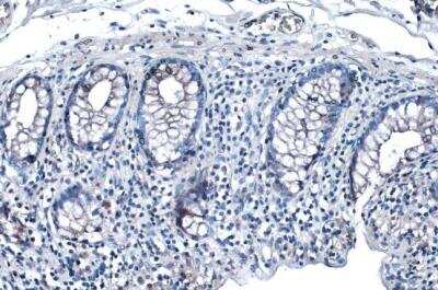 Immunohistochemistry-Paraffin: Desmoglein-2 Antibody [NBP1-33374]