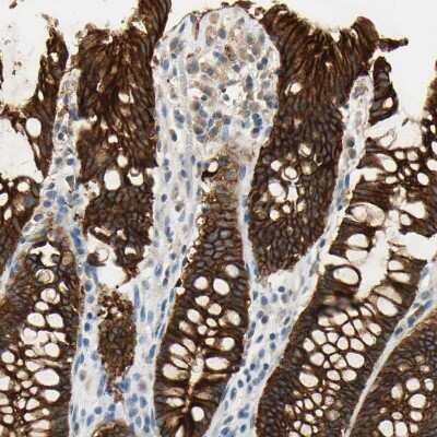 Immunohistochemistry-Paraffin: Desmoglein-2 Antibody [NBP1-85709]