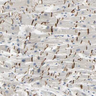 Immunohistochemistry-Paraffin: Desmoglein-2 Antibody [NBP1-85709]