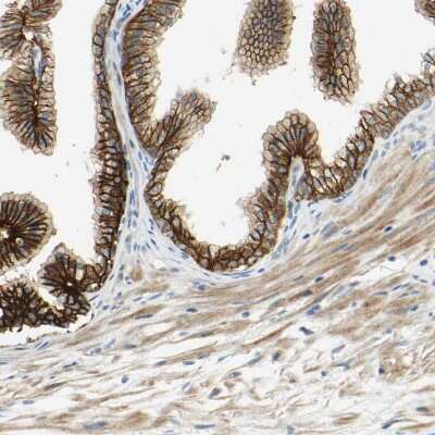 Immunohistochemistry-Paraffin: Desmoglein-2 Antibody [NBP1-85709]