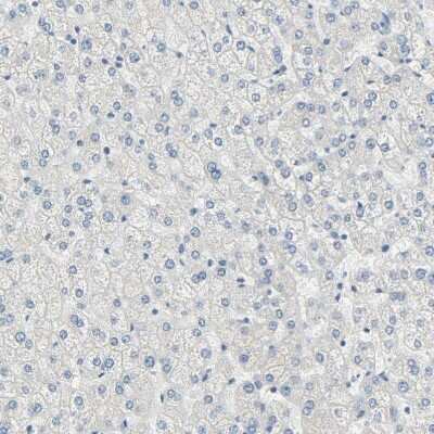 Immunohistochemistry-Paraffin: Desmoglein-2 Antibody [NBP1-85709]