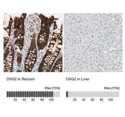 Immunohistochemistry-Paraffin: Desmoglein-2 Antibody [NBP1-85709]