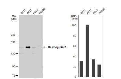 Western Blot: Desmoglein-2 Antibody [NBP1-33374]