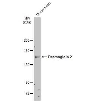 Western Blot: Desmoglein-2 Antibody [NBP1-33374]