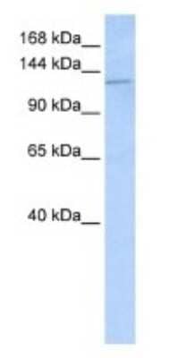 Western Blot: Desmoglein-2 Antibody [NBP1-59200]