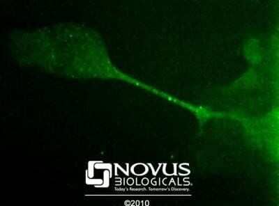 Immunocytochemistry/ Immunofluorescence: Desmoglein-3 Antibody (5G11) - Azide and BSA Free [NBP2-80694]