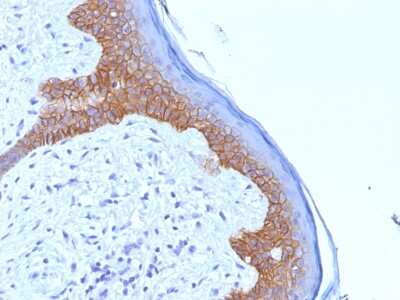 Immunohistochemistry-Paraffin: Desmoglein-3 Antibody (5G11) - Azide and BSA Free [NBP3-08408]