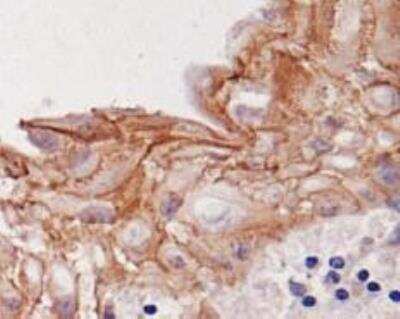Immunohistochemistry: Desmoglein-3 Antibody (5G11) - BSA Free [NB100-1643]