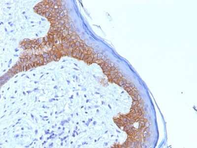 Immunohistochemistry-Paraffin: Desmoglein-3 Antibody (5G11) [NBP3-07872]