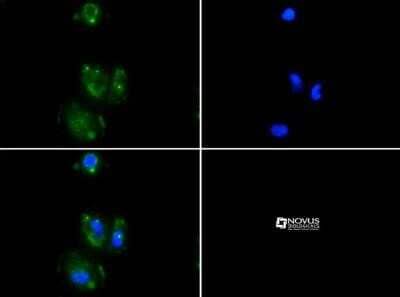 Immunocytochemistry/ Immunofluorescence: Desmoglein-3 Antibody (5H10) - Azide and BSA Free [NBP2-80695]