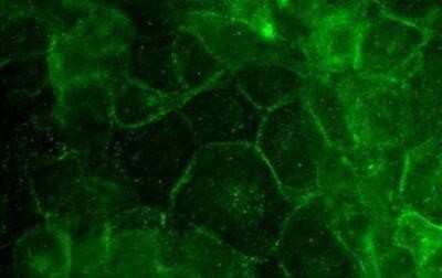 Immunocytochemistry/ Immunofluorescence: Desmoglein-3 Antibody (5H10) - Azide and BSA Free [NBP2-80695]