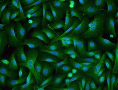 Immunocytochemistry/ Immunofluorescence: Desmoglein-3 Antibody (5H10) - Azide and BSA Free [NBP2-80695]