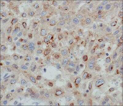 Immunohistochemistry: Desmoglein-3 Antibody (5H10) - Azide and BSA Free [NBP2-80695]