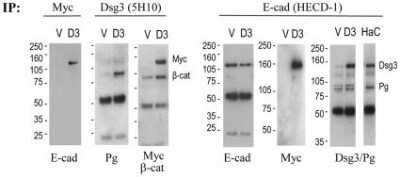 Western Blot: Desmoglein-3 Antibody (5H10)Azide and BSA Free [NBP2-80695]