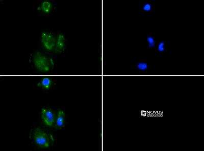 Immunocytochemistry/ Immunofluorescence: Desmoglein-3 Antibody (5H10) [NBP1-78984]