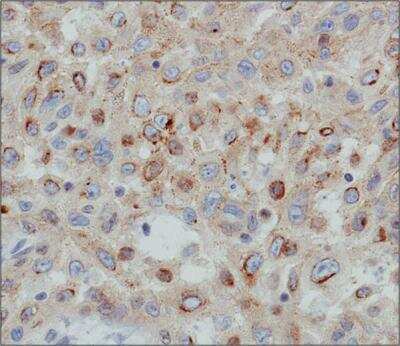 Immunohistochemistry: Desmoglein-3 Antibody (5H10) [NBP1-78984]