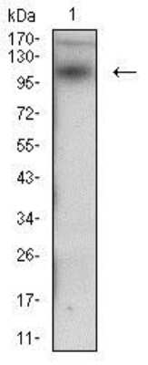 Western Blot: Desmoglein-3 Antibody (6G2C11)BSA Free [NBP2-37259]