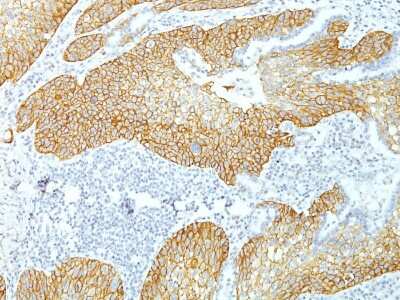 Immunohistochemistry-Paraffin: Desmoglein-3 Antibody (DSG3/1535) - Azide and BSA Free [NBP3-08409]