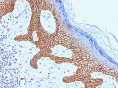 Immunohistochemistry-Paraffin: Desmoglein-3 Antibody (DSG3/1535) - Azide and BSA Free [NBP3-08409]