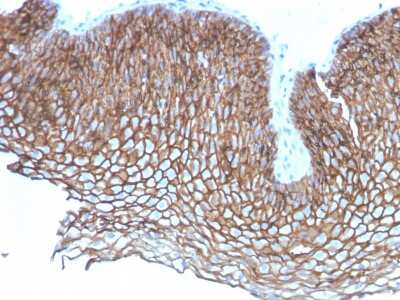 Immunohistochemistry-Paraffin: Desmoglein-3 Antibody (DSG3/2837) - Azide and BSA Free [NBP3-08411]