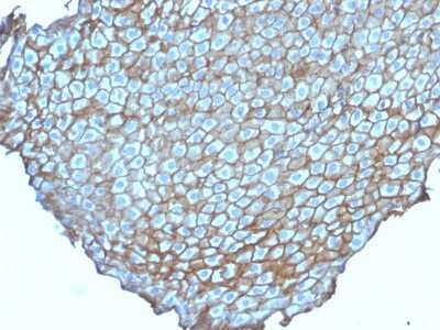 Immunohistochemistry-Paraffin: Desmoglein-3 Antibody (DSG3/2838) [NBP3-07876]