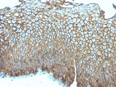 Immunohistochemistry-Paraffin: Desmoglein-3 Antibody (DSG3/2839) - Azide and BSA Free [NBP3-08480]