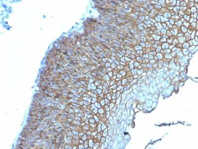 Immunohistochemistry-Paraffin: Desmoglein-3 Antibody (DSG3/2839) - Azide and BSA Free [NBP3-08480]