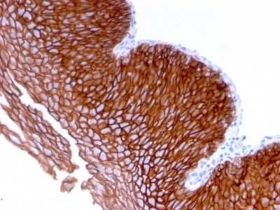 Immunohistochemistry-Paraffin: Desmoglein-3 Antibody (DSG3/2839) - Azide and BSA Free [NBP3-08480]