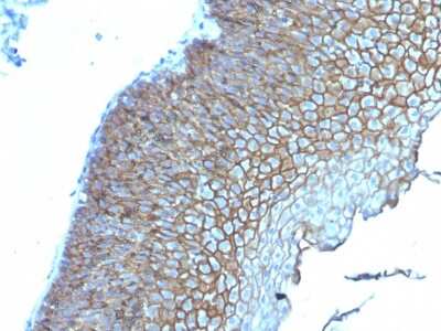 Immunohistochemistry-Paraffin: Desmoglein-3 Antibody (DSG3/2839) [NBP3-07885]
