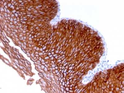 Immunohistochemistry-Paraffin: Desmoglein-3 Antibody (DSG3/2839) [NBP3-07885]